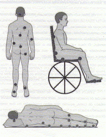 Tratamento das úlceras de decúbito/escaras